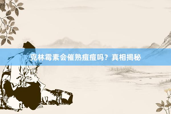 克林霉素会催熟痘痘吗？真相揭秘